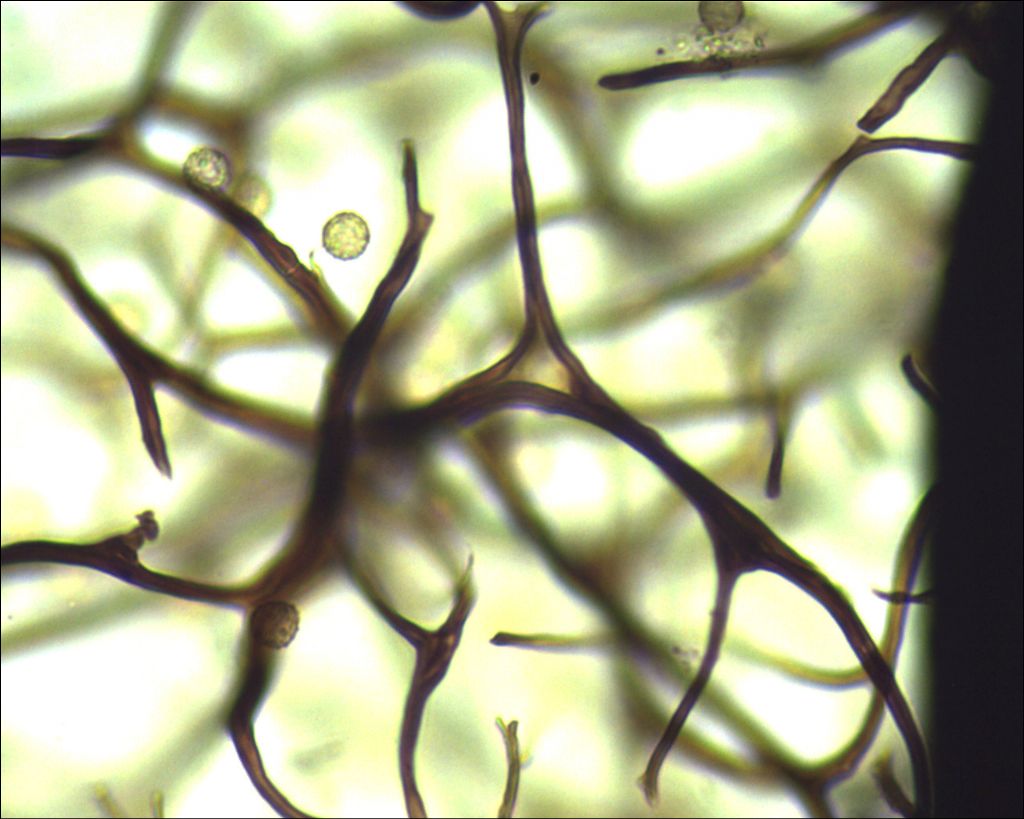 Comatricha o Stemonitopsis?